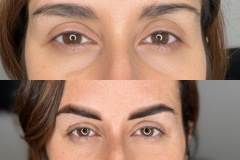 06-trucco-permanente-sopracciglia-asimmetria
